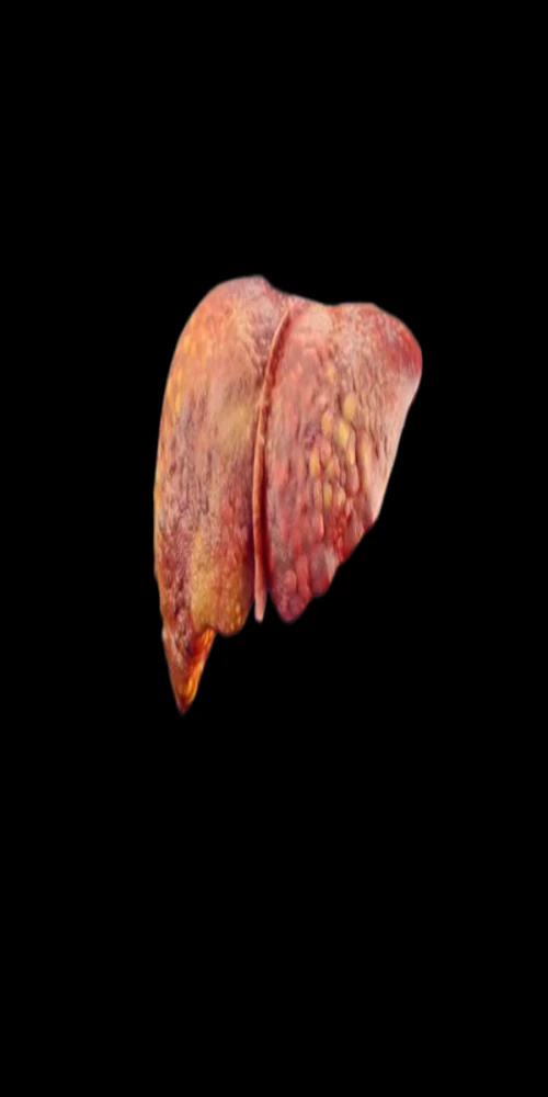 Internal Medicine-2