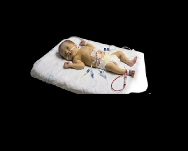 Early Onset Neonatal Sepsis: Identification, Management, and Clinical Outcomes