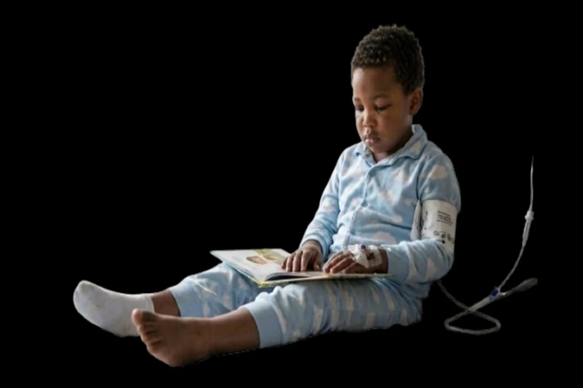 Nephrotic Syndrome in Children: Epidemiology, Clinical Presentation, and Management Strategies