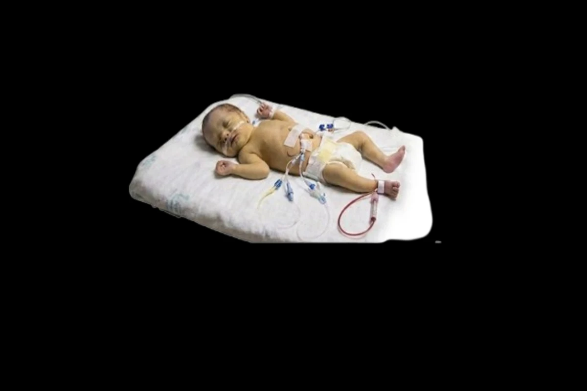 Early Onset Neonatal Sepsis: Identification, Management, and Clinical Outcomes