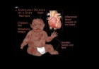 Kawasaki Disease in the Modern Era: An Evidence-Based Review of Diagnostic Criteria, Therapeutic Strategies, and Lifetime Cardiovascular Surveillance