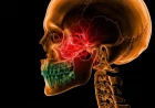 Pediatric Epistaxis Unpacked: A Clinician's Guide to Stopping Nosebleeds and Spotting the Red Flags