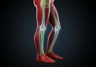 Rickets in Children: A Clinical Guide to Recognizing, Diagnosing and Treating Soft Bones