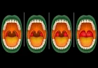 Recurrent Tonsillitis in Children: When Does a Sore Throat Become a Surgical Decision?