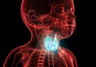 Congenital Hypothyroidism in a Rwandan Infant: A Case Report