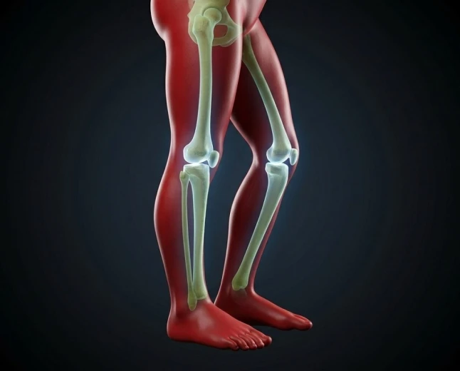 Rickets in Children: A Clinical Guide to Recognizing, Diagnosing and Treating Soft Bones