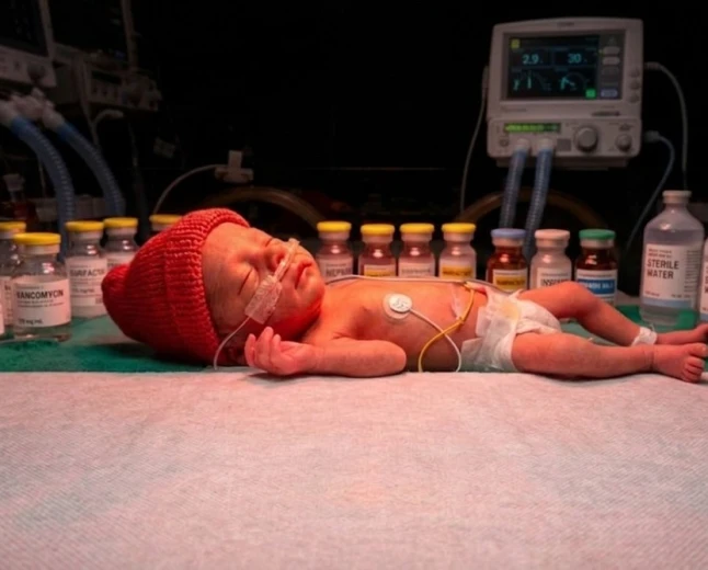 Surfactant Therapy in Newborns: A Complete Guide to Types, Timing, and Techniques of Administration